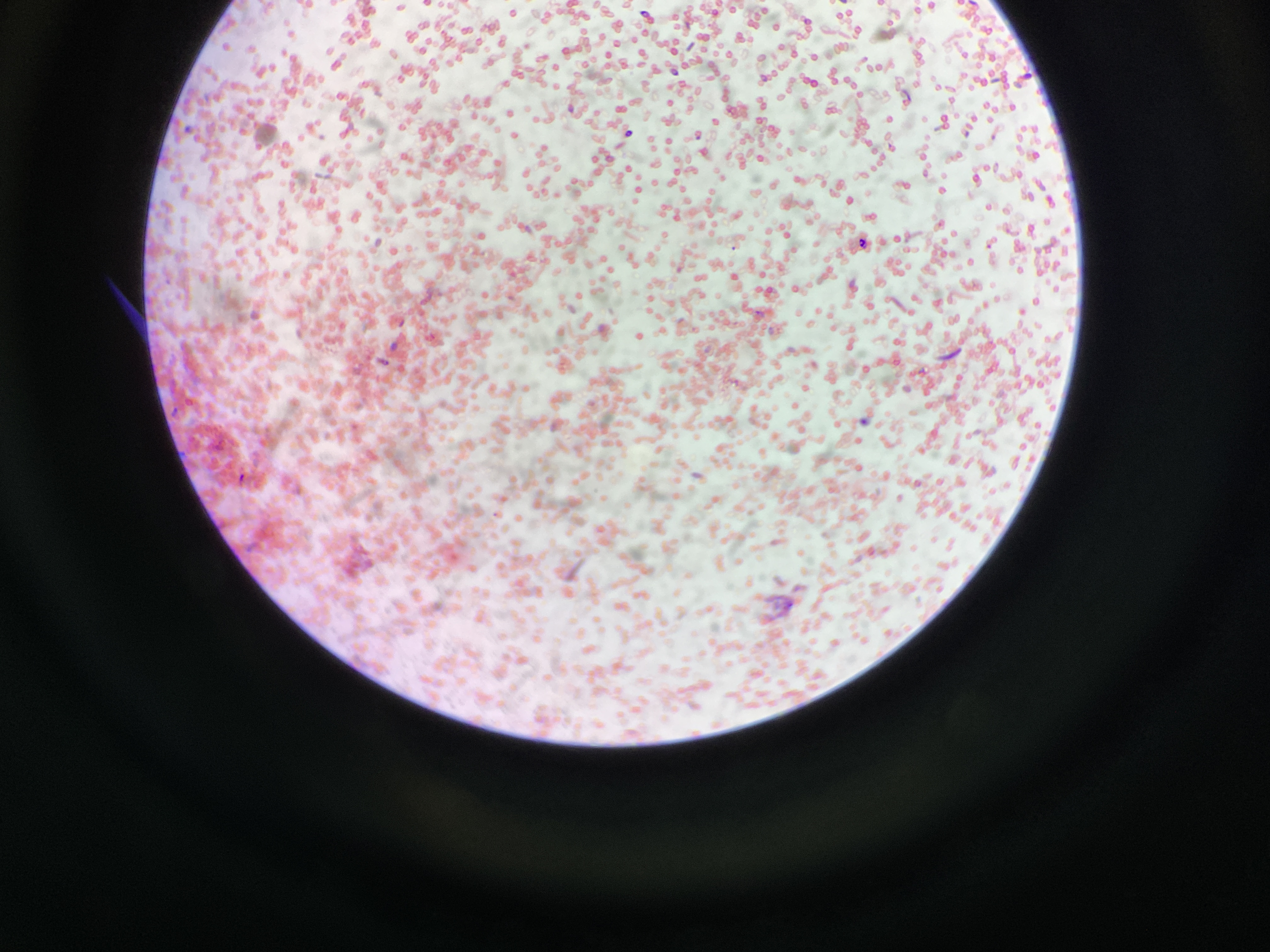 03_microorganism_mold_sample.JPG